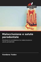 Vandana Yadav | Malocclusione E Salute Parodontale | Taschenbuch | Italienisch