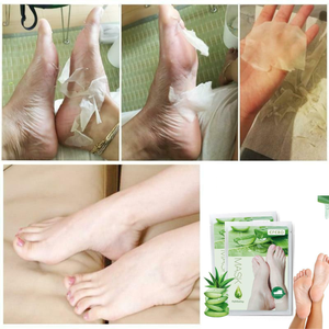 baby feet after care