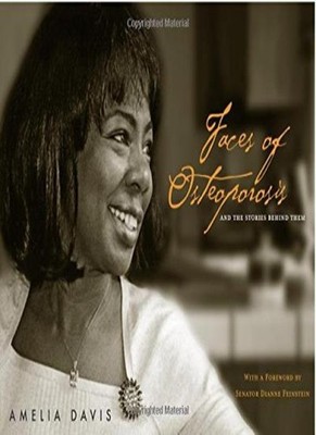 Faces of Osteoporosis,Amelia Davis