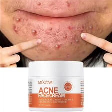 2PCS Acne Cream Pimple Cream for Face, Oil Control Pimple Remover Cream