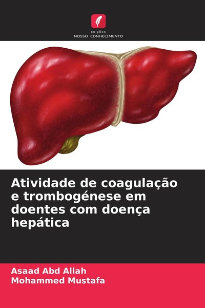 Asaad Abd Allah (U. A.) | Atividade De CoagulaçãO E TrombogéNese Em Doentes...-image