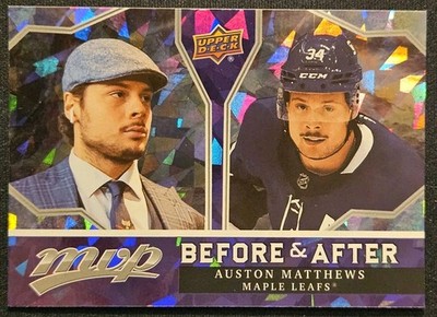21-22 MVP Auston Matthews Before & After     Toronto Maple Leafs 