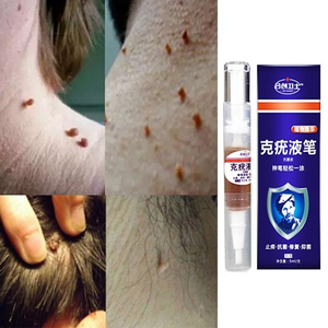 What Are Skin Tags From