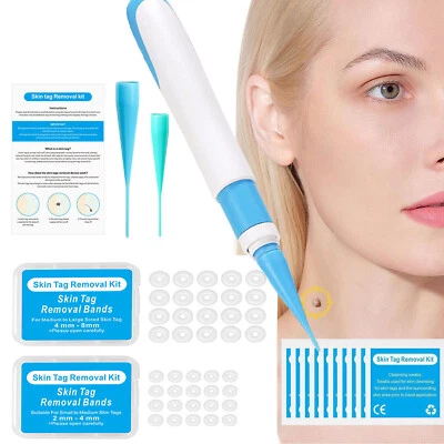 ZREE Stielwarzen Entferner, Skin Tag Entferner,2-in-1 Stielwarzen Entfernen schnell.