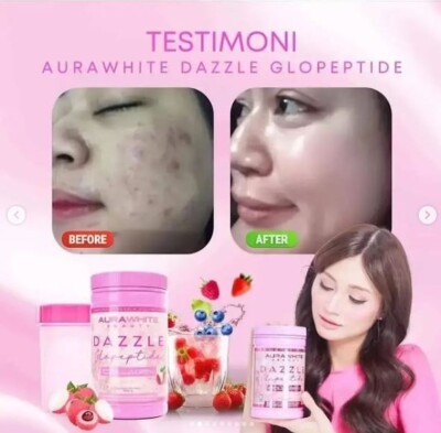 Poudre De Collagène AuraWhite Dazzle Glopeptide Avec Astaxanthine - 800g - Soin éclaircissant Et Anti-âge
