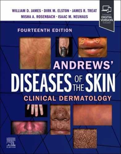 Andrews' Diseases of the Skin: Clinical - Hardcover, by James MD William - New