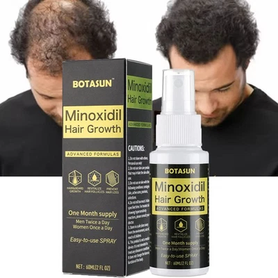 BOTASUN Minoxidil 5% Extra Strength Hair Growth Spray Fast Regrowth Scalp Treatment 60ml