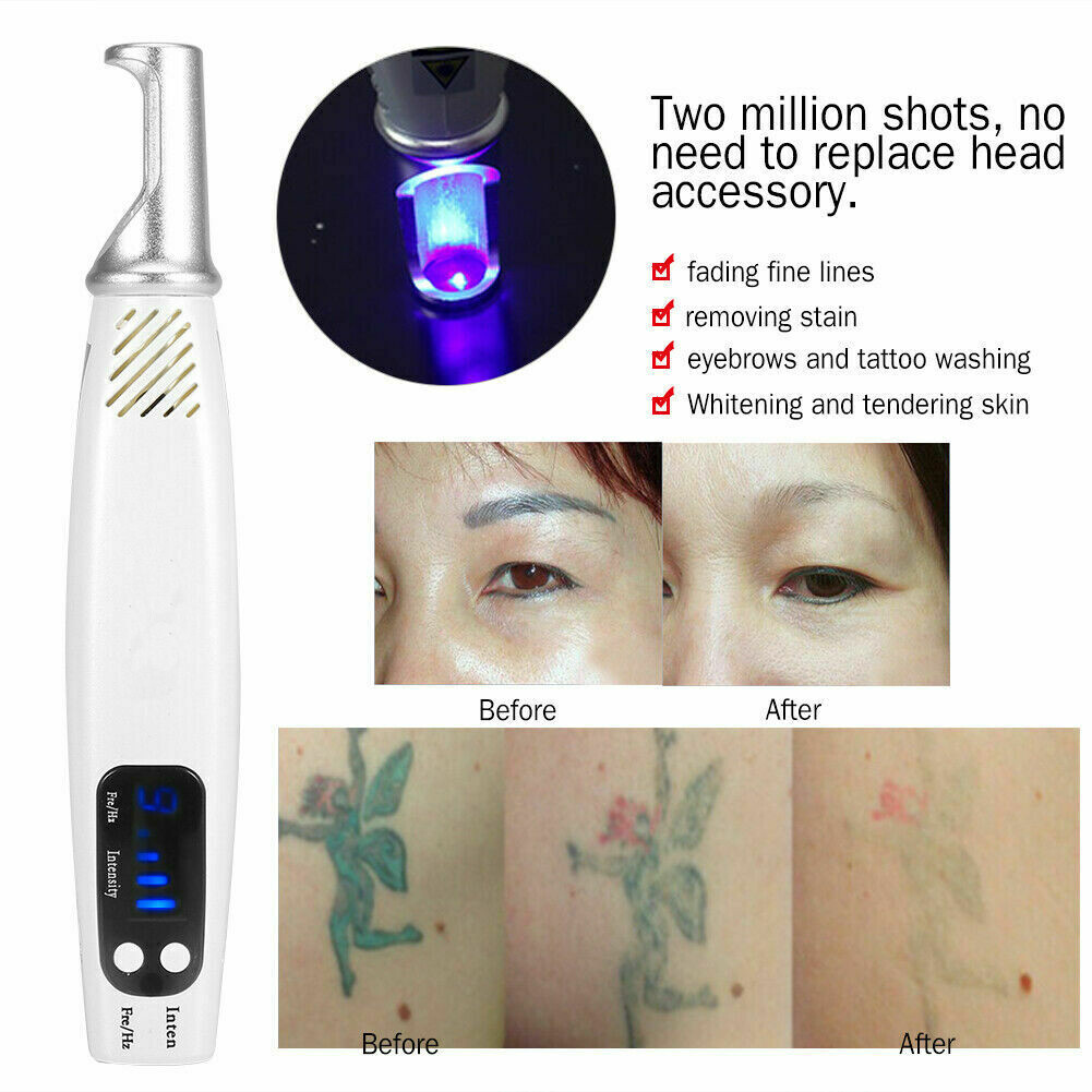 Picosecond Skin Laser Beauty Machine Tattoo/Spot Removal Pigment Pen Portable
