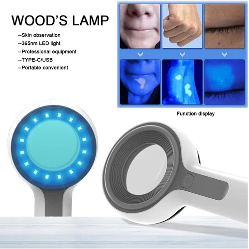 UV Woods Lamp Examination Dermatology Skin Anyalyzer For Vitiligo CE FDA - Picture 1 of 11