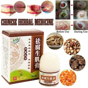 Herbal Removal Rot Myogenic Cream Bedsores Paste Treat ...