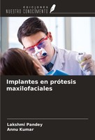 Implantes En PróTesis Maxilofaciales Annu Kumar