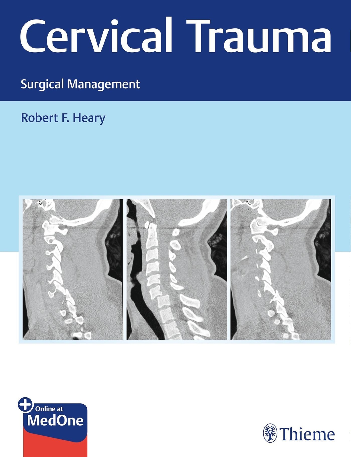 Thumbnail - Cervical Trauma Surgical Management Robert Heary Buch 1 Buch Englisch
