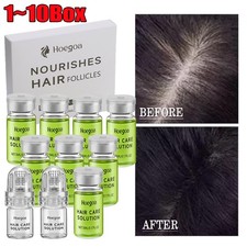 Micro Infusion Hair Regrowth System Advanced Hair Growth Treatment for Men&Women