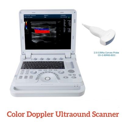 Portable Color Doppler Ultrasound Scanner Machine Diagnostic Laptop Convex probe