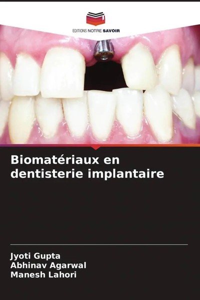 Jyoti Gupta (U. A.) | BiomatéRiaux En Dentisterie Implantaire | Taschenbuch-image