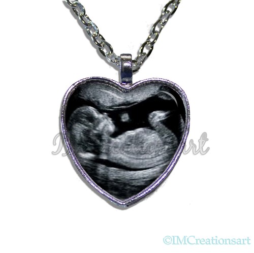 PERSONALIZED PHOTO SONOGRAM BABY CUSTOM 