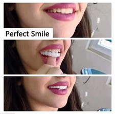 Snap On Veneers Temporary Teeth Cover Upper Lower Denture Kit