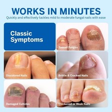 Powerful 4-Pack Fungal Nail Treatment Pens for Quick Relief and Restoration