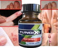 FUNGI XL ANTIFUNGAL CL EXTRA STRENGTH FUNGUS NAILS Support