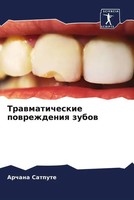 Archana Satpute | Trawmaticheskie Powrezhdeniq Zubow | Taschenbuch | Russisch