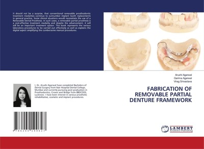 Arushi Agarwal (u. a.) | FABRICATION OF REMOVABLE PARTIAL DENTURE FRAMEWORK