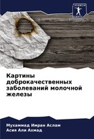 Kartiny Dobrokachestwennyh Zabolewanij Molochnoj Zhelezy Aslam (U. A.) Buch 2024