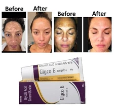 GLYCO 6 GLYCOLIC ACID CREAM 6% (30GMS) + FREE SHIPPING cream
