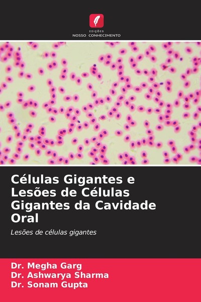 CéLulas Gigantes E LesõEs De CéLulas Gigantes Da Cavidade Oral Megha Garg-image