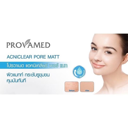 15 g Provamed Acniclear Pore Matte Serum Facial Skincare Controls Oil Smooth - Picture 10 of 12