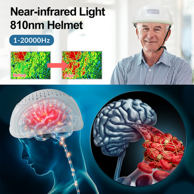 LED Brain Helmet Improve Memory Loss & Cognitive Decline with 810nm Light