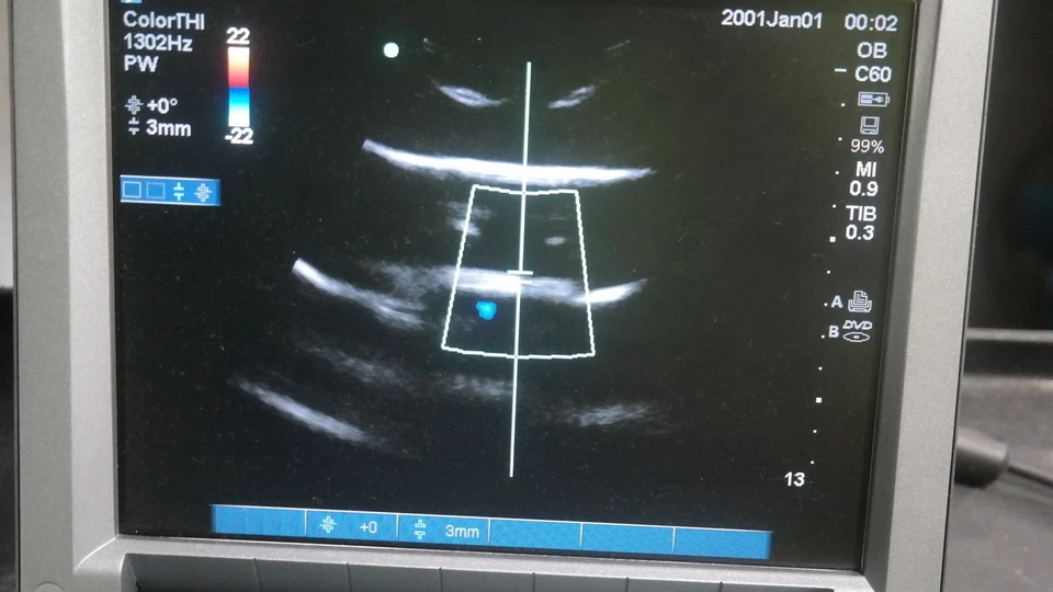 Sistema de Ultrassom SonoSite M-Turbo P08189-45 + Transdutor C60x/5-2MHz + Garantia - Imagem 3 de 4