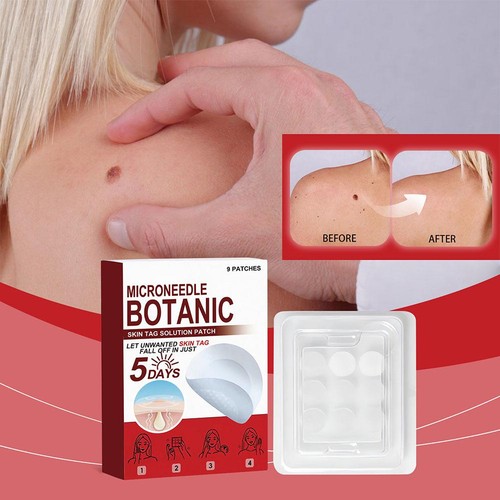 Parche para etiquetas de piel y acné MICRONEEDLE BOTANIC 9 piezas parches removedores de etiquetas de piel - 30 % de descuento. - Imagen 5 de 19
