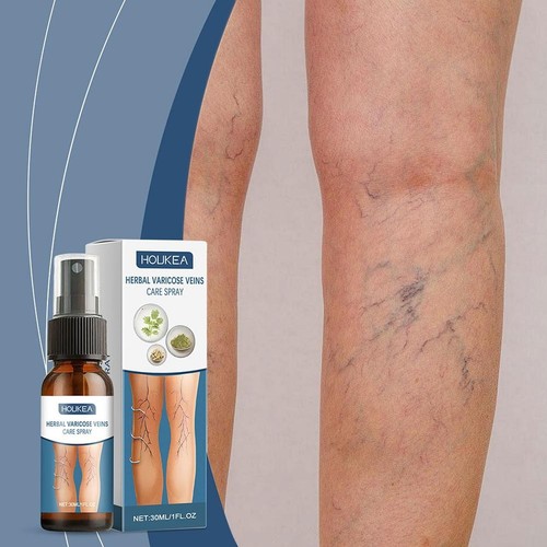 AEROSOL HERBAL PARA EL CUIDADO DE LAS VENAS VARICOSAS Promover el flujo sanguíneo Spray para piernas 30 ml/1 oz R4V2 - Imagen 4 de 14