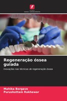 RegeneraçãO óSsea Guiada InovaçõEs Nas TéCnicas De RegeneraçãO óSsea Taschenbuch