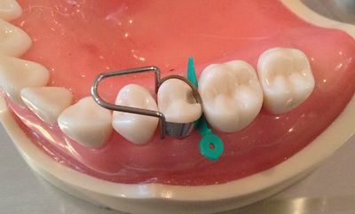 Dental Matrix Bands / The u Dental Bands / Assorted Kit