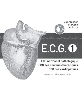 ECG tome 1: ECG normal et pathologique, ECG des douleurs thoraciques, ECG des ca