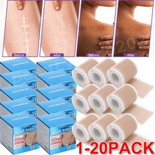 SAFE & MEDICAL GRADE Scar Removal Tape Silicone Scar Sheet Treatment Patch UK