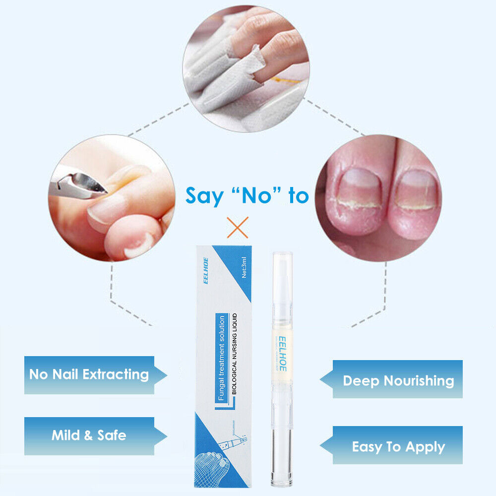 4 Stück Anti Nagelpilz Stift Nagelpilz Behandlung Nagelpflege Nagelreparatur