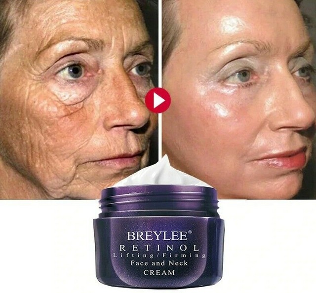 best neck lightening cream