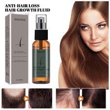Hair Loss Prevention Serum Spray for Strengthening Hair Roots and Scalp Repair