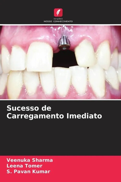 Sucesso De Carregamento Imediato Veenuka Sharma (U. A.) Taschenbuch 2022-image