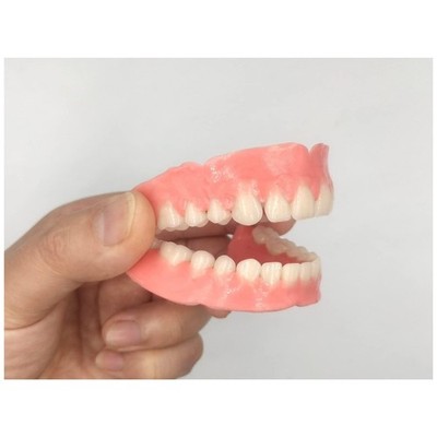 Custom Denture Kit for Smile Makeover