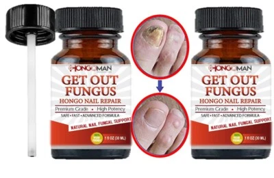 FUNGI NAIL HONGOSAN CORP 2 X ANTI FUNGAL Support EXTRA STRENGTH TOENAIL FUNGUS ATHLETES FOOT FUNGI NAIL