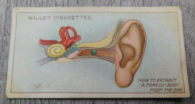 Wills's First Aid Cigarettes Tobacco Trade Card VTG No. 30 Foreign Body In Ear