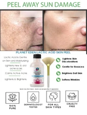 Purest Grade Lactic Acid Peel for DARK SPOTS, Sun Damage, Wrinkles & AGE SPOTS