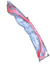 OMP MA/1681 Front Strut Brace Vauxhall Astra F Mk3 GSI