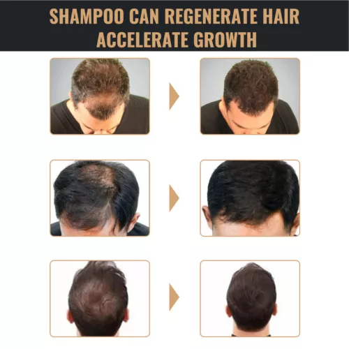 Shampoo attivatore radici, SPARTAN shampoo perdita capelli, shampoo attivatore radici - Foto 8 di 12