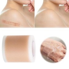 Scar Patch Silicone Scar Paste Effectively Remove Scars Reusable and Washab G1S4