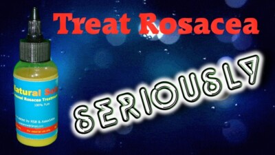 Treat Rosacea Seriously With Your Personal Rosacea Treatment