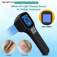 Excimer 308nm Phototherapy Lamp Portable for Skin Disorders Home Care Therapy